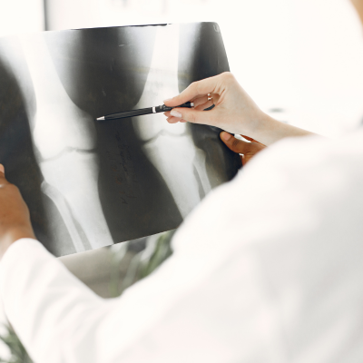 साइएटिका पेन (Sciatica Pain) – कारण, लक्षण, उपचार और होमियोपैथिक समाधान Sciatica Pain Kya Hota Hai?